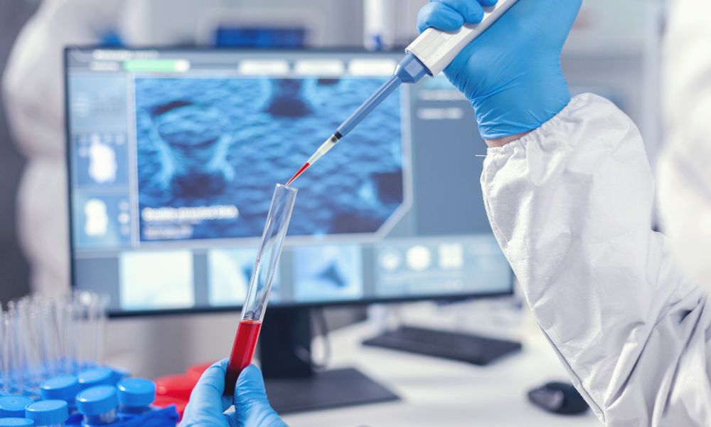 Covid-19 ANTİKOR TESTLERİ