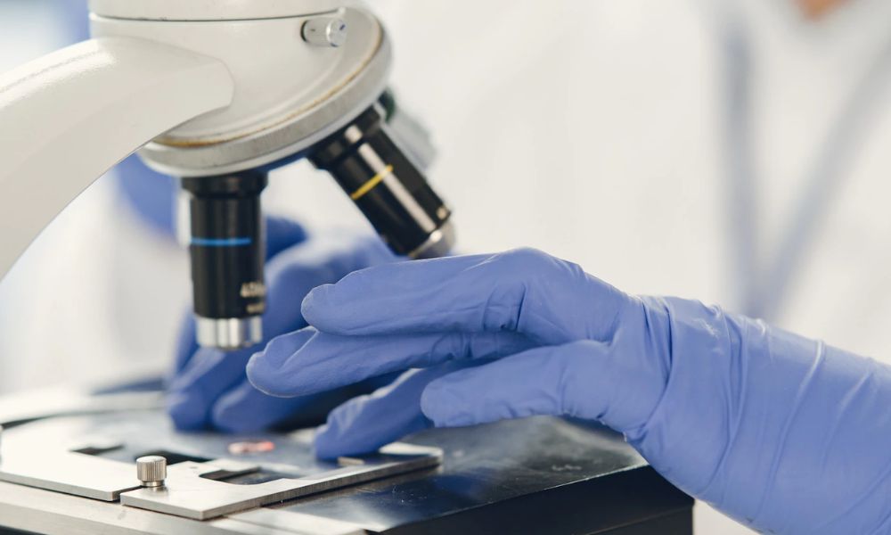 A.F Genital Sistem Testi